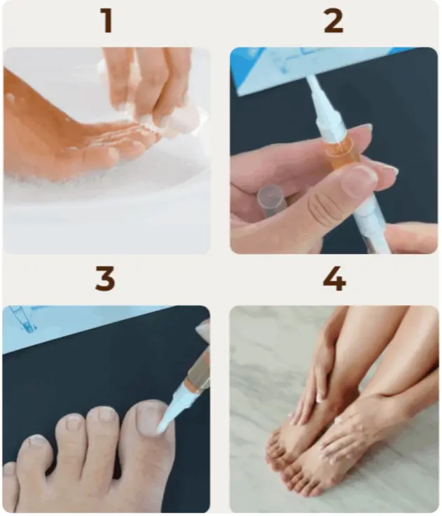 How to use Okita Toenail Fungus Pen